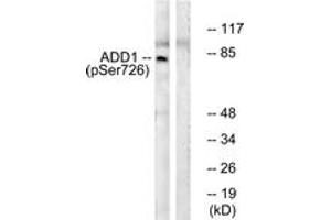 Western blot analysis of extracts from HeLa cells treated with Forskolin 40nM 30', using ADD1 (Phospho-Ser726) Antibody. (alpha Adducin Antikörper  (pSer726))