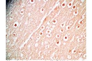 Immunohistochemistry (IHC) image for anti-Chromosome 2 Open Reading Frame 40 (C2orf40) (AA 108-132), (Preproprotein) antibody (ABIN2873086)