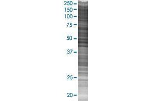 SPESP1 transfected lysate. (SPESP1 293T Cell Transient Overexpression Lysate(Denatured))