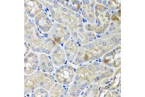 Immunohistochemistry of paraffin-embedded mouse kidney using USH1C antibody (ABIN5972448) at dilution of 1/100 (40x lens). (USH1C Antikörper)