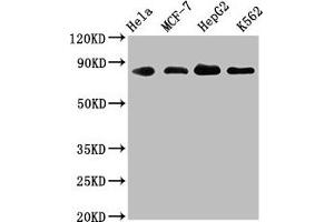 Western Blot Positive WB detected in: Hela whole cell lysate, MCF-7 whole cell lysate, HepG2 whole cell lysate, K562 whole cell lysate All lanes: ARNT antibody at 1. (Rekombinanter ARNT Antikörper)