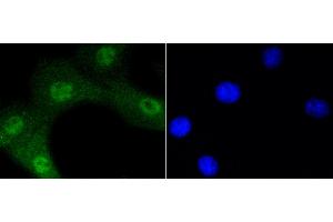 3T3 cells were stained with Akt1(Ser473) (12A1) Monoclonal Antibody  at [1:200] incubated overnight at 4C, followed by secondary antibody incubation, DAPI staining of the nuclei and detection. (AKT1 Antikörper  (pSer473))