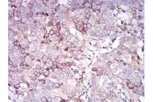 Immunohistochemistry (IHC) image for anti-Cadherin 11 (CDH11) (AA 468-617) antibody (ABIN5542425)