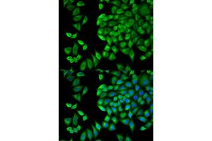 Immunofluorescence analysis of HeLa cells using WNK1 antibody. (WNK1 Antikörper)