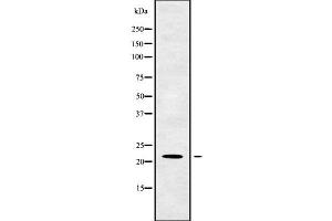 Western blot analysis of TM2D1 using K562 whole cell lysates (TM2D1 Antikörper  (Internal Region))