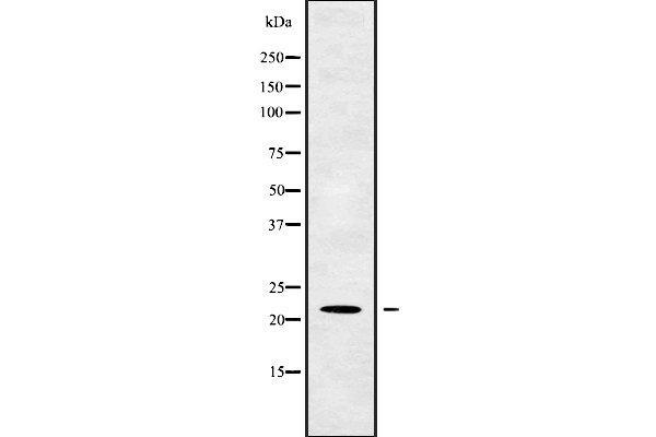 TM2D1 Antikörper  (Internal Region)