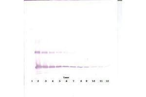 Image no. 3 for anti-Interleukin 33 (IL33) antibody (ABIN465632) (IL-33 Antikörper)