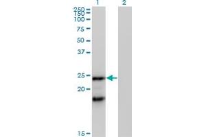 Western Blot analysis of IGLL1 expression in transfected 293T cell line by IGLL1 MaxPab polyclonal antibody. (IGLL1 Antikörper  (AA 1-213))