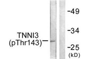 Western blot analysis of extracts from mouse heart, using TNNI3 (Phospho-Thr142) Antibody. (TNNI3 Antikörper  (pThr142))
