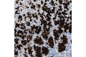 Immunohistochemical staining of human stomach with ULBP1 polyclonal antibody  shows strong cytoplasmic positivity in glandular cells at 1:50-1:200 dilution. (ULBP1 Antikörper)