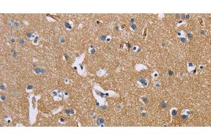Immunohistochemistry of paraffin-embedded Human brain using BSG Polyclonal Antibody at dilution of 1:60 (CD147 Antikörper)