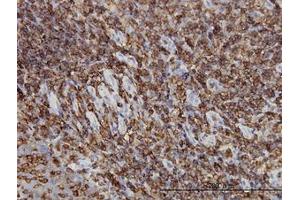 Image no. 2 for anti-Hematopoietic Cell-Specific Lyn Substrate 1 (HCLS1) (AA 266-356) antibody (ABIN598723) (HCLS1 Antikörper  (AA 266-356))