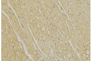 ABIN6269348 at 1/100 staining Mouse muscle tissue by IHC-P.