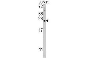 Western blot analysis of TPT1 Antibody (Center) in Jurkat cell line lysates (35ug/lane). (TPT1 Antikörper  (Middle Region))