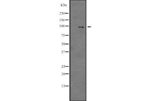 Western blot analysis of E2F7 expression in SP2/0 cell lysate ,The lane on the left is treated with the antigen-specific peptide. (E2F7 Antikörper)