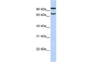 WB Suggested Anti-FAM38B Antibody Titration:  0. (PIEZO2 Antikörper  (Middle Region))