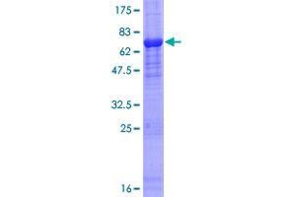 FBXO31 Protein (AA 1-367) (GST tag)