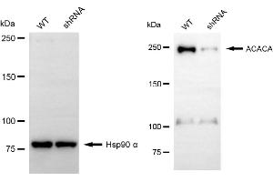 Western blotting analysis using ACACA antibody (ABIN7797442). (Acetyl-CoA Carboxylase alpha Antikörper)