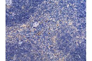anti-Fermitin Family Member 3 (FERMT3) (Internal Region) antibody