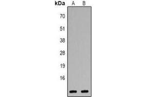 Western blot analysis of CXCL1 expression in Jurkat (A), Hela (B) whole cell lysates. (CXCL1 Antikörper  (C-Term))