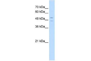 STEAP3 antibody used at 5 ug/ml to detect target protein. (STEAP3 Antikörper  (N-Term))
