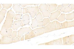 Immunohistochemistry (IHC) image for anti-Leukemia Inhibitory Factor (LIF) (AA 2-201) antibody (ABIN7425671)