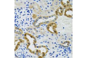 Immunohistochemistry of paraffin-embedded mouse kidney using POLG2 antibody (ABIN5974040) at dilution of 1/100 (40x lens). (POLG2 Antikörper)