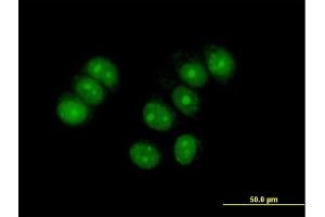 Immunofluorescence of purified MaxPab antibody to ZNF554 on MCF-7 cell. (ZNF554 Antikörper  (AA 1-538))