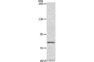 Western blot analysis of Mouse liver tissue, using ABCB6 Polyclonal Antibody at dilution of 1:250 (ABCB6 Antikörper)