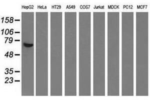 Image no. 4 for anti-alpha-Fetoprotein (AFP) antibody (ABIN1496486) (alpha Fetoprotein Antikörper)