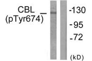 Western blot analysis of extracts from HepG2 cells treated with Na2VO3 0. (CBL Antikörper  (pTyr674))
