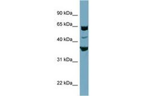 SEC22C antibody  (AA 179-228)
