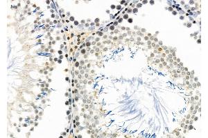 ABIN6261240 and ABIN6266855 at 1/100 staining Rat testis tissue by IHC-P.