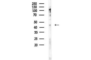 anti-Collagen and Calcium Binding EGF Domains 1 (CCBE1) (Internal Region) antibody