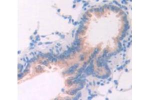 IHC-P analysis of Rat Tissue, with DAB staining. (TPSAB1 Antikörper  (AA 29-148))
