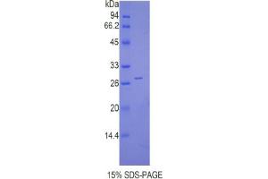 SDS-PAGE analysis of Mouse Cathepsin C Protein. (CTSC Protein)