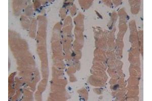 IHC-P analysis of Mouse Skeletal Muscle Tissue, with DAB staining. (MYH2 Antikörper  (AA 1238-1472))