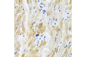 Immunohistochemistry of paraffin-embedded mouse heart using PHPT1 antibody (ABIN3021488, ABIN3021489, ABIN3021490 and ABIN6215139) at dilution of 1:100 (40x lens). (PHPT1 Antikörper  (AA 1-125))