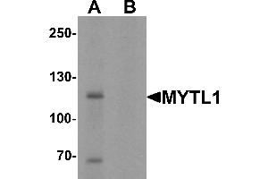 Western Blotting (WB) image for anti-Myelin Transcription Factor 1-Like (MYT1L) (C-Term) antibody (ABIN1077393) (MYT1L Antikörper  (C-Term))