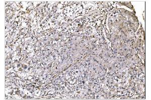 IHC analysis of NDEL1 using anti-NDEL1 antibody (ABIN7602511). (NDEL1 Antikörper  (AA 80-320))
