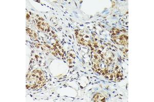Immunohistochemistry (IHC) image for anti-Metallothionein 2A (MT2A) (AA 1-61) antibody (ABIN3015842)
