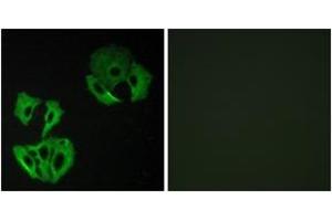 Immunofluorescence analysis of A549 cells, using MADD Antibody. (MADD Antikörper  (AA 751-800))