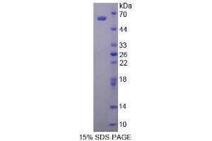 SDS-PAGE analysis of Human ALDH1A1 Protein. (ALDH1A1 Protein)
