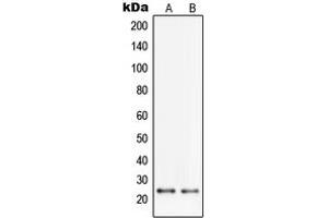 Western blot analysis of PGRMC2 expression in HL60 (A), HeLa (B) whole cell lysates.