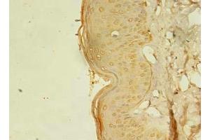 Immunohistochemistry of paraffin-embedded human skin tissue using ABIN7168075 at dilution of 1:100 (RTKN2 Antikörper  (AA 1-163))