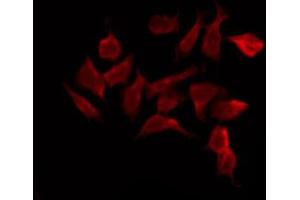 ABIN6272420 staining K562 by IF/ICC. (RPS6KA6 Antikörper  (C-Term))