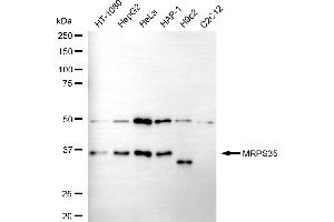 anti-Mitochondrial Ribosomal Protein S35 (MRPS35) antibody