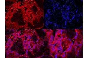 Formalin-fixed and paraffin embedded human placenta labeled with Rabbit Anti-TLR7 Polyclonal Antibody, Unconjugated  DAPI staining
