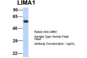 Host:  Rabbit  Target Name:  LIMA1  Sample Type:  Human Fetal Heart  Antibody Dilution:  1. (LIMA1 Antikörper  (N-Term))