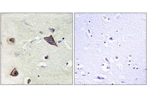 Immunohistochemistry analysis of paraffin-embedded human brain tissue, using NMDAR1 (Ab-896) Antibody. (GRIN1/NMDAR1 Antikörper  (AA 862-911))